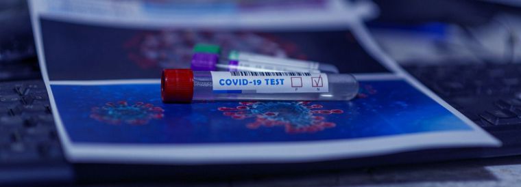 Díaz Ayuso pide a la Unión Europea que valide los test COVID-19 en las farmacias