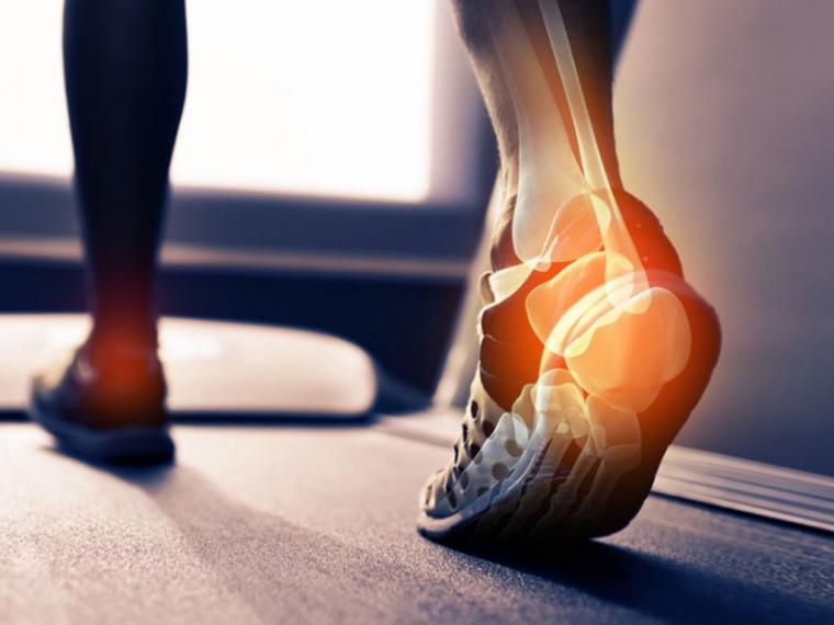 Las lesiones más frecuentes de los “runners” y cómo curarlas para llegar a la meta