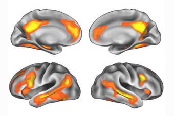 El embarazo modifica el cerebro de la madre