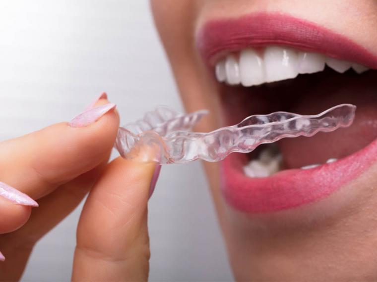 La compra de férulas de descarga dental por Internet y el uso de estas pueden esconder enfermedades graves