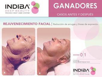 Indiba Deep Beauty, belleza de dentro a fuera en Geli d´Mora Boadilla