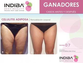 Indiba Deep Beauty, belleza de dentro a fuera en Geli d´Mora Boadilla