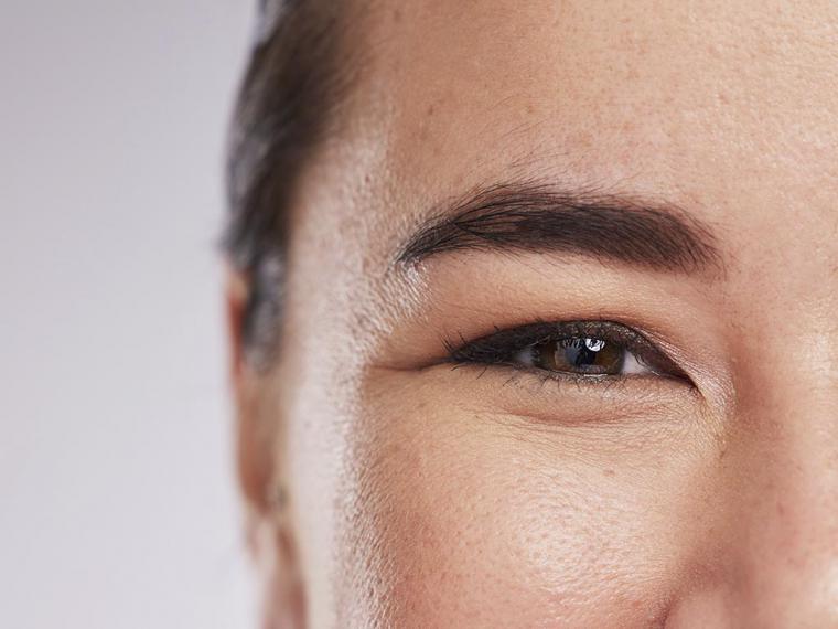 Injerto de cejas: ¿qué sabemos de la cirugía de la que todos hablan?
