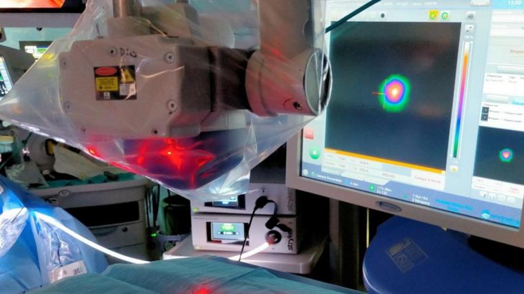 En el Hospital público Clínico San Carlos, se emplea una técnica innovadora para la radiolocalización de lesiones pulmonares, utilizando un navegador electromagnético