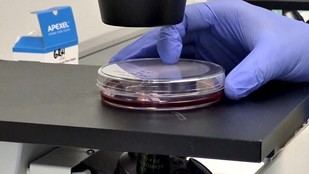 Avances en la vacuna oral contra el Ébola en Madrid