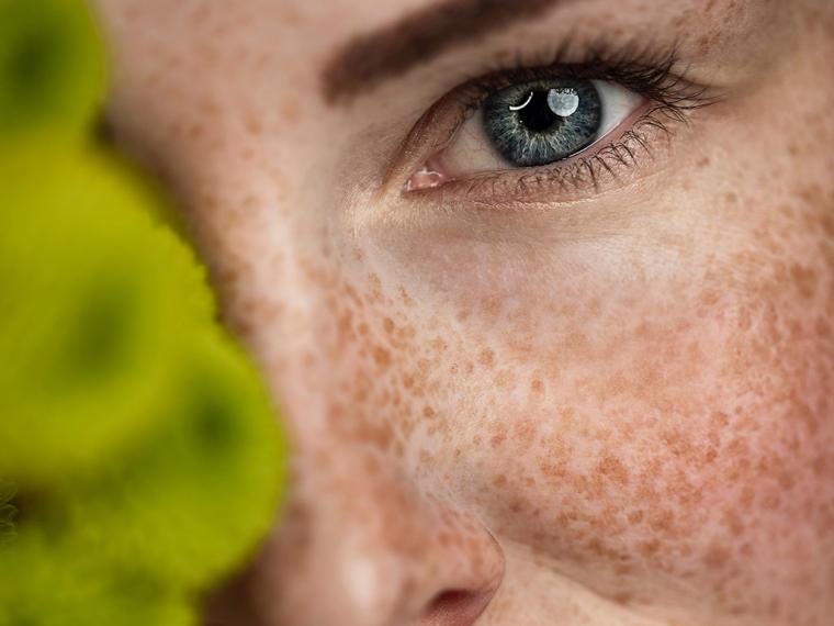 Los activos más eficaces contra las manchas de la piel