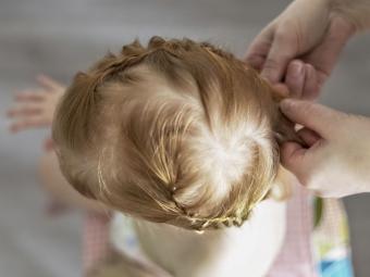 La excesiva tensión capilar provocada por moños y coletas podría provocar alopecia de tracción