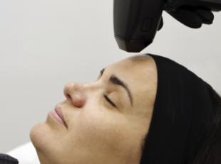 Radiofrecuencia + Microneedling, el tratamiento que transforma la mirada