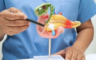 Investigadores logran mejorar la eficacia de la quimioterapia en cáncer de páncreas al adelgazar la membrana tumoral