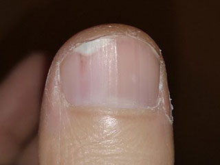 Claves para lograr unas uñas de los pies sanas y cuidadas este verano