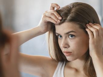 La dermatitis seborreica y su vinculación real con la caída del cabello