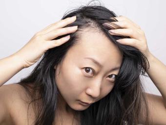 Alopecia frontal fibrosante, un tipo de caída con mayor incidencia en mujeres