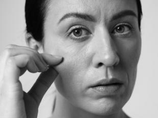 Acné en la menopausia: causas según una farmacéutica