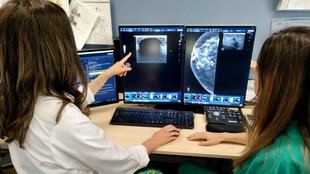 Avance en tratamiento de cáncer de mama en hospitales madrileños