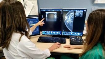 Avance en tratamiento de cáncer de mama en hospitales madrileños