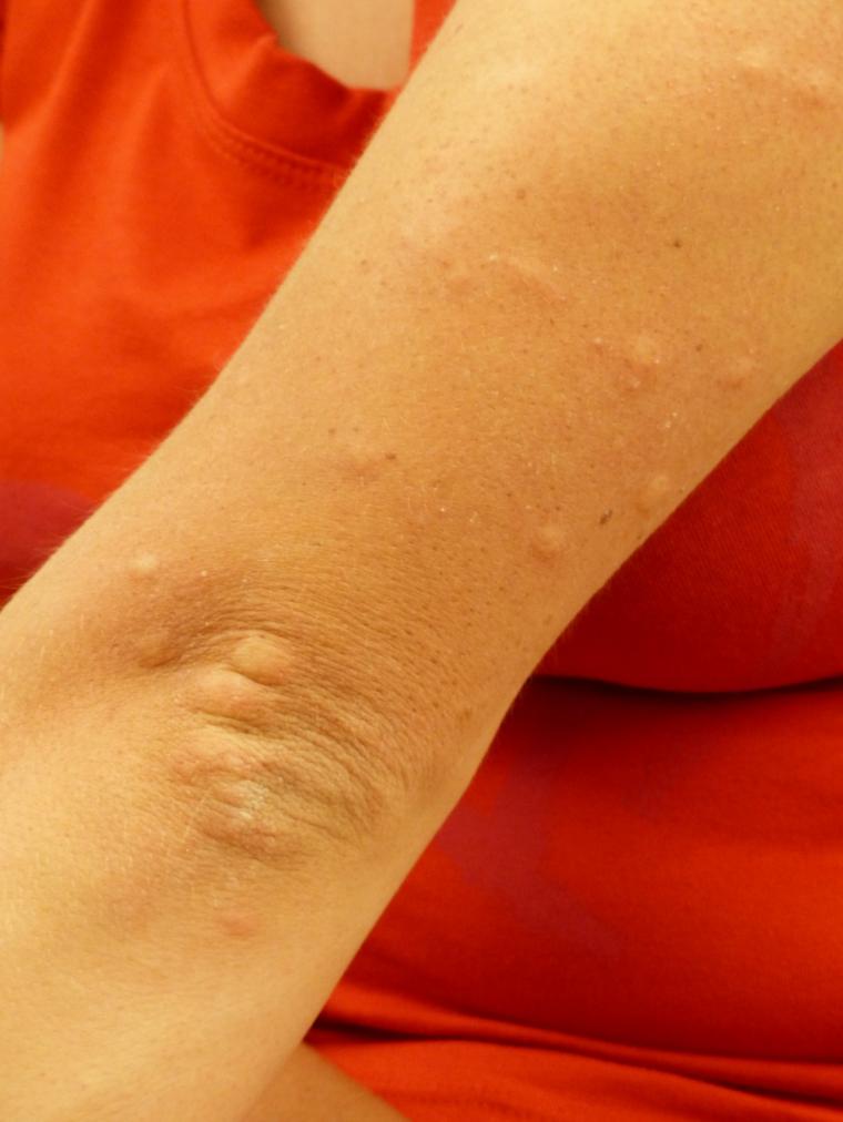 Loción antimosquitos ecológica
